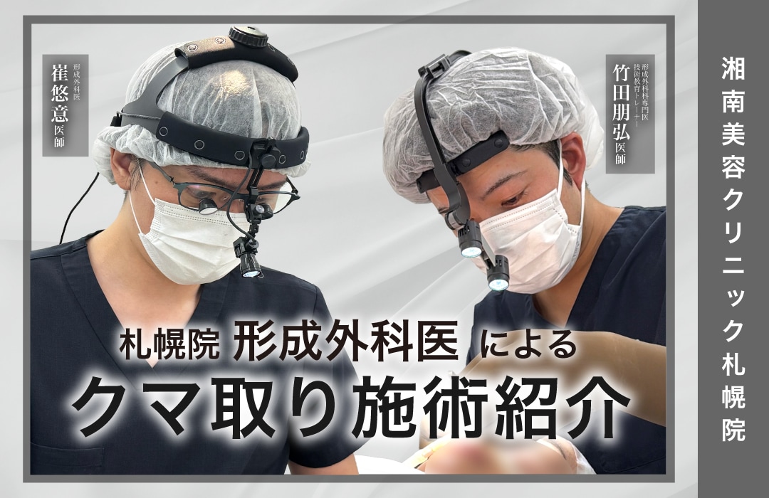 【クマ取り】SBC札幌院で受けられる人気の「クマ取り」施術をご紹介🪄【若返り】【札幌】