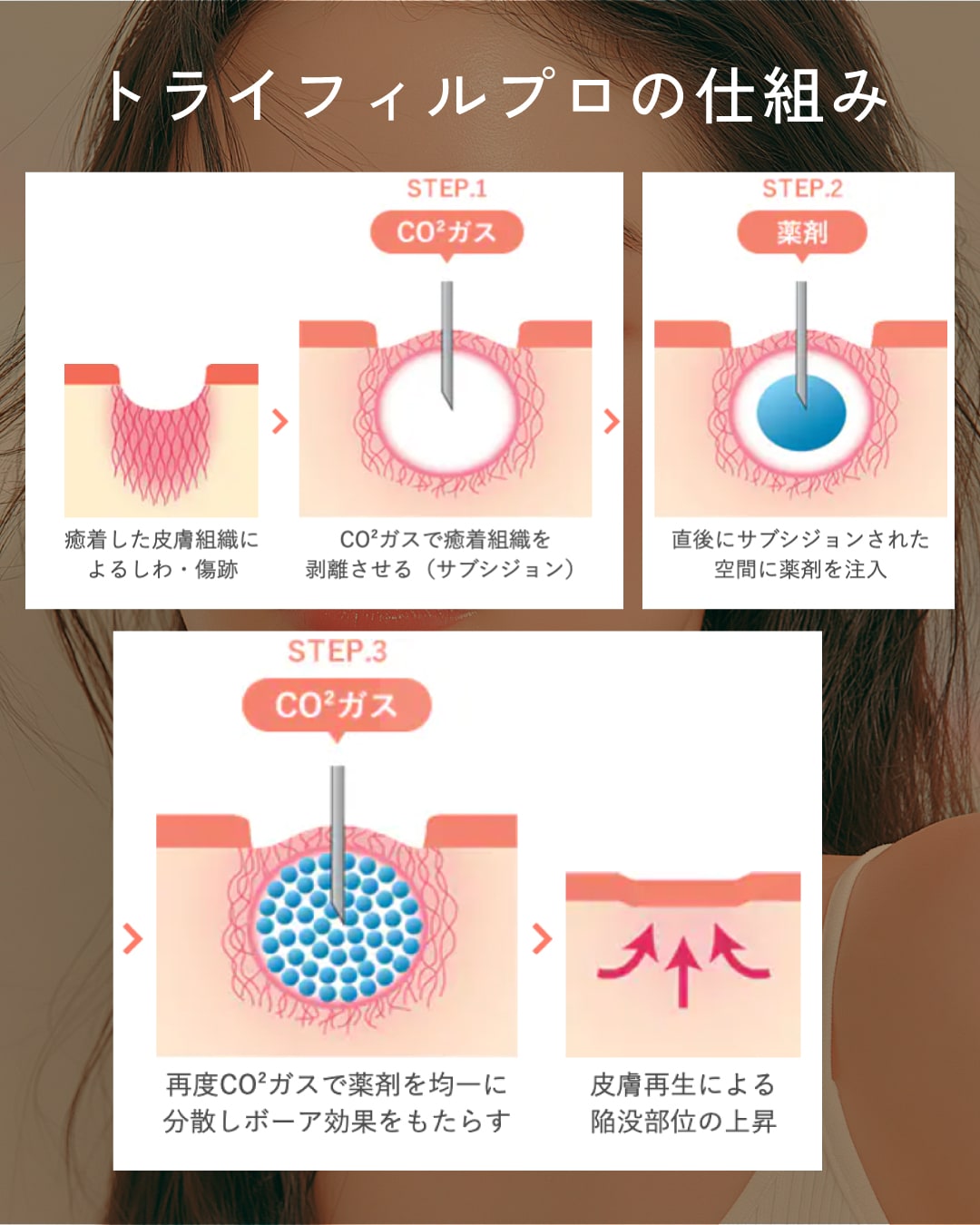 お肌の内側から肌質改善