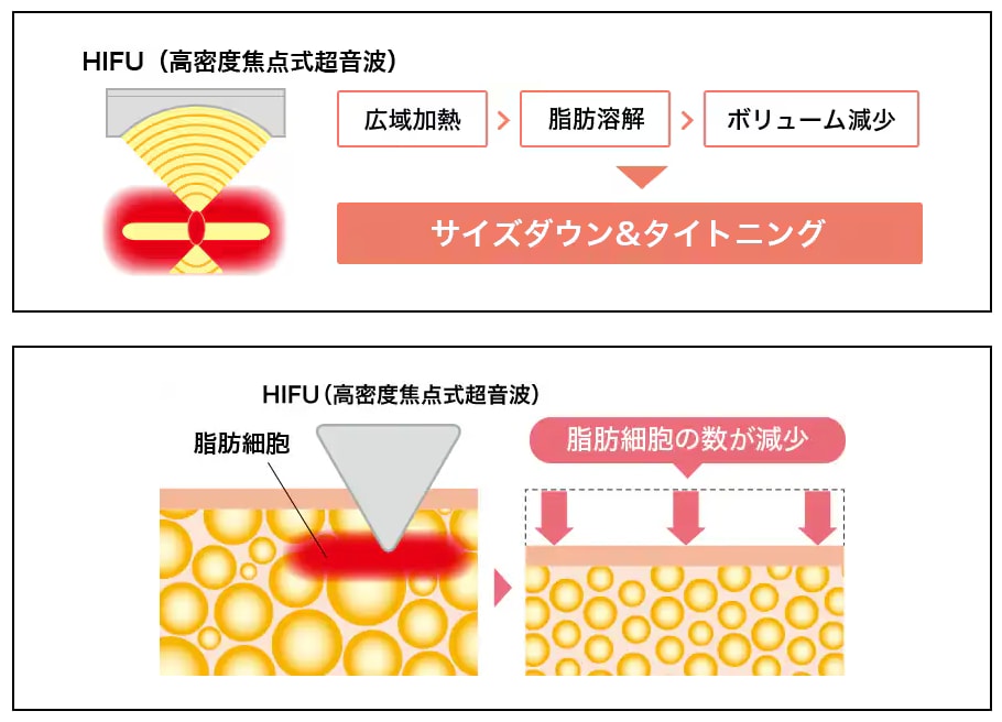 脂肪溶解のメカニズム