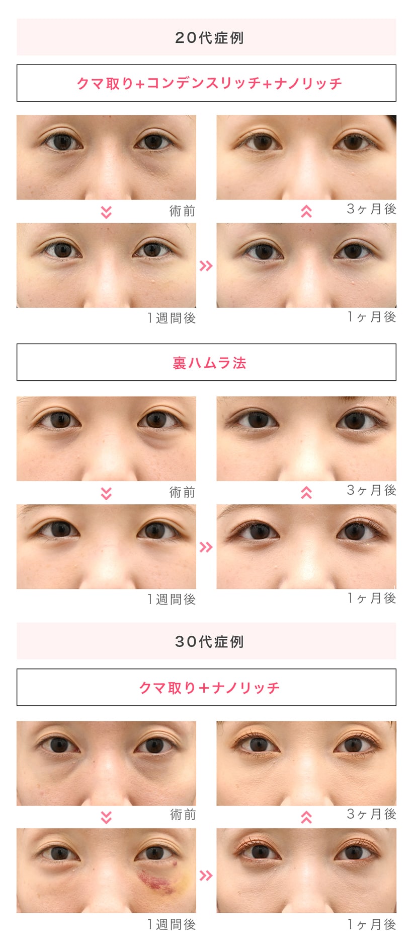 20代〜30代の症例