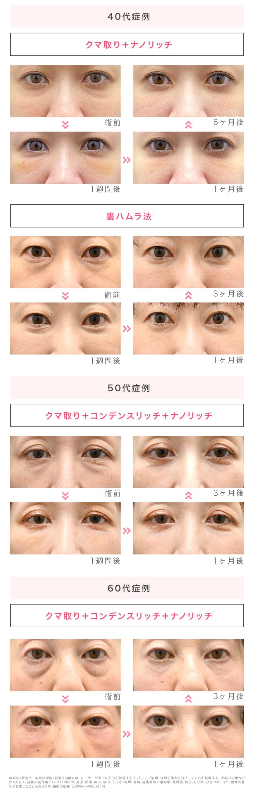 40代〜60代の症例