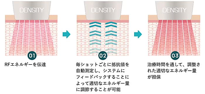 肌の状態をリアルタイムで測定し、あなたに合わせた均一なエネルギーを照射