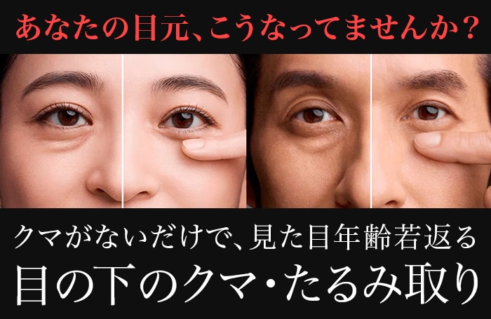 目の下の切らないクマ・たるみ(ふくらみ)取り