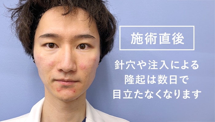 ダウンタイムは比較的短め