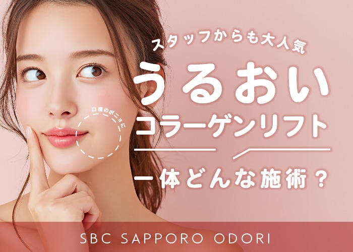 【スタッフからも大人気🫧】うるおいコラーゲンリフトって一体どんな施術？【湘南美容クリニック札幌大通院】【うるコラ】