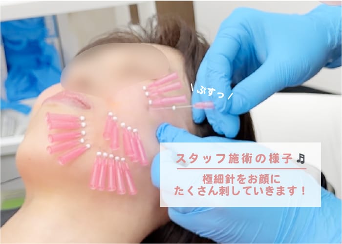 スタッフ施術は信頼の証!