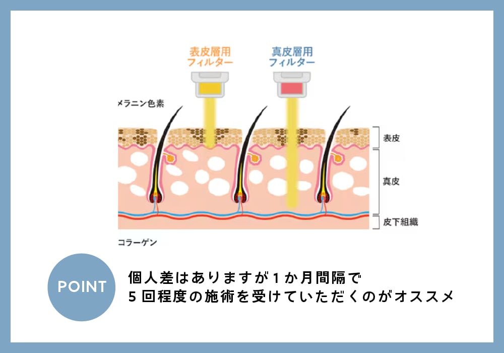 フォトダブル®