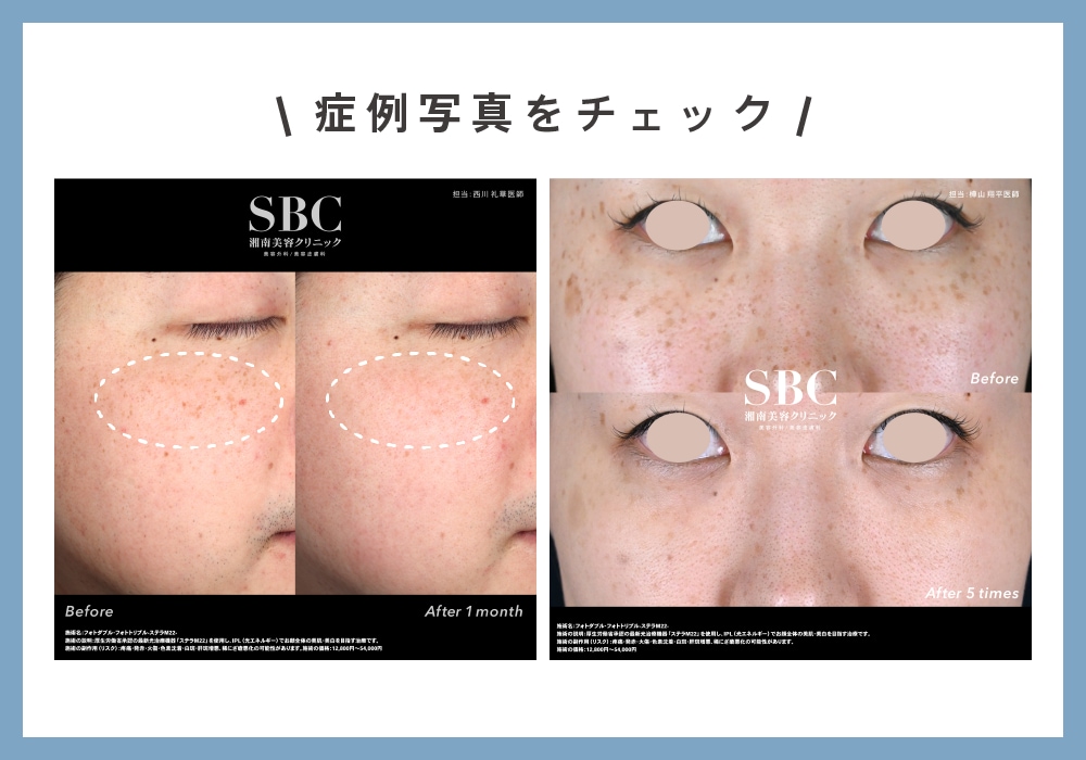 お顔のモヤモヤがスッキリ✨