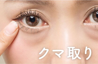 【クマ取り】すっきりお目元で脱・老け顔☆