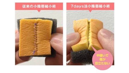 痛みやダウンタイムが心配な方に「7days法」