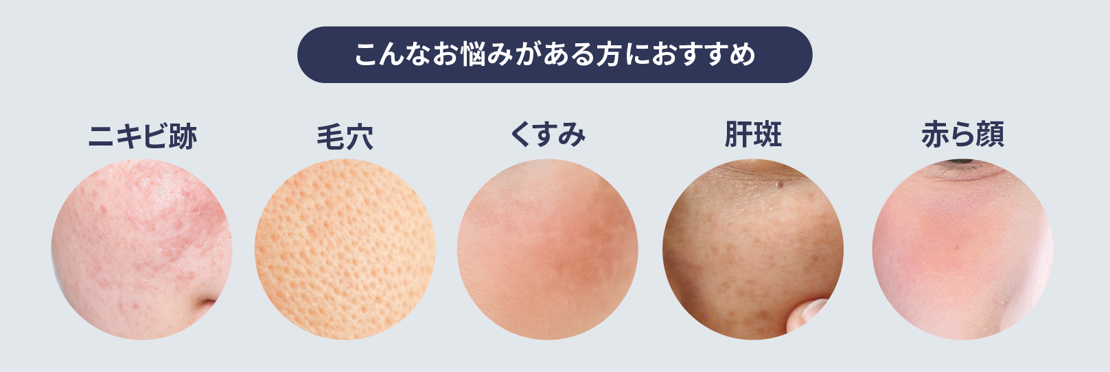 こんなお悩みがある方におすすめ