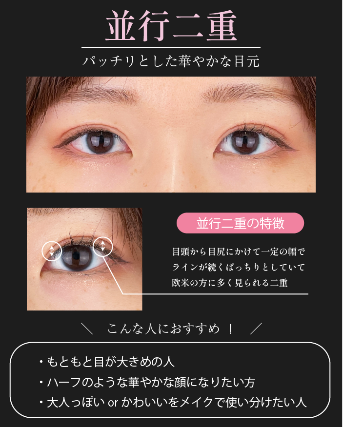 並行二重