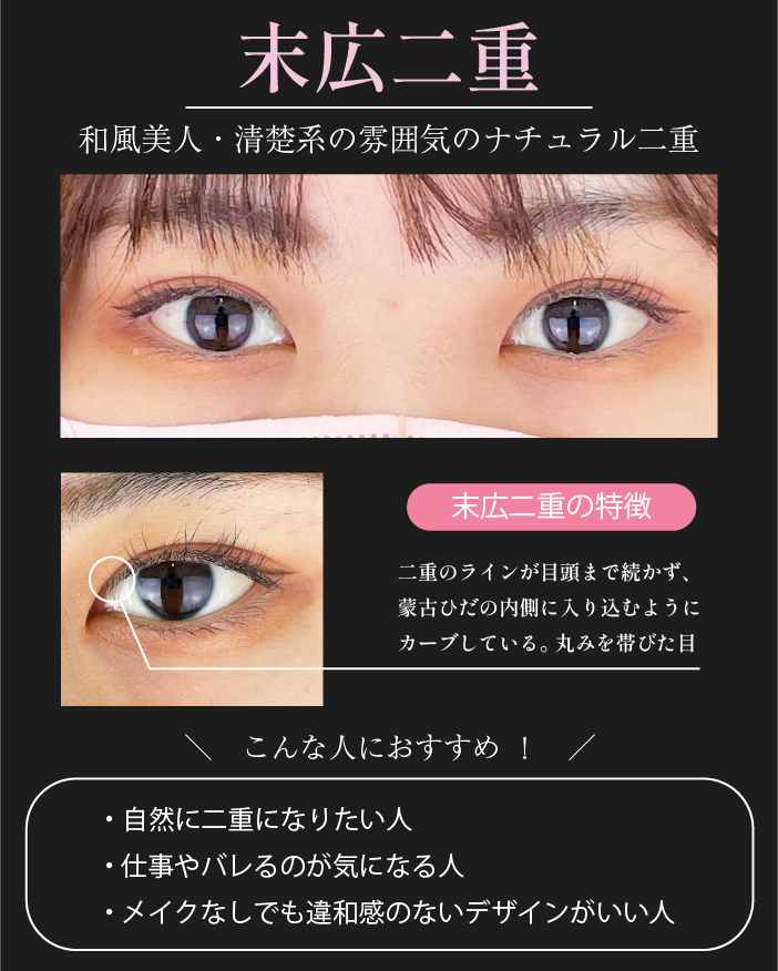 末広二重