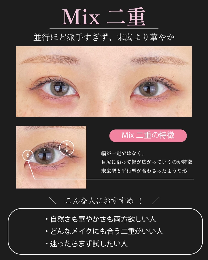 Mix二重