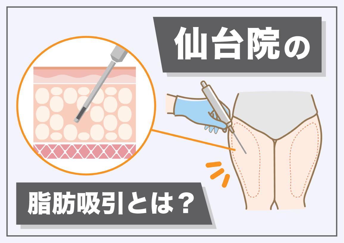 【脂肪吸引するなら】施術の魅力と仙台院のこだわりをご紹介！：湘南美容クリニック仙台院