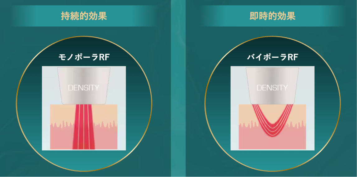 デンシティってどんな施術？