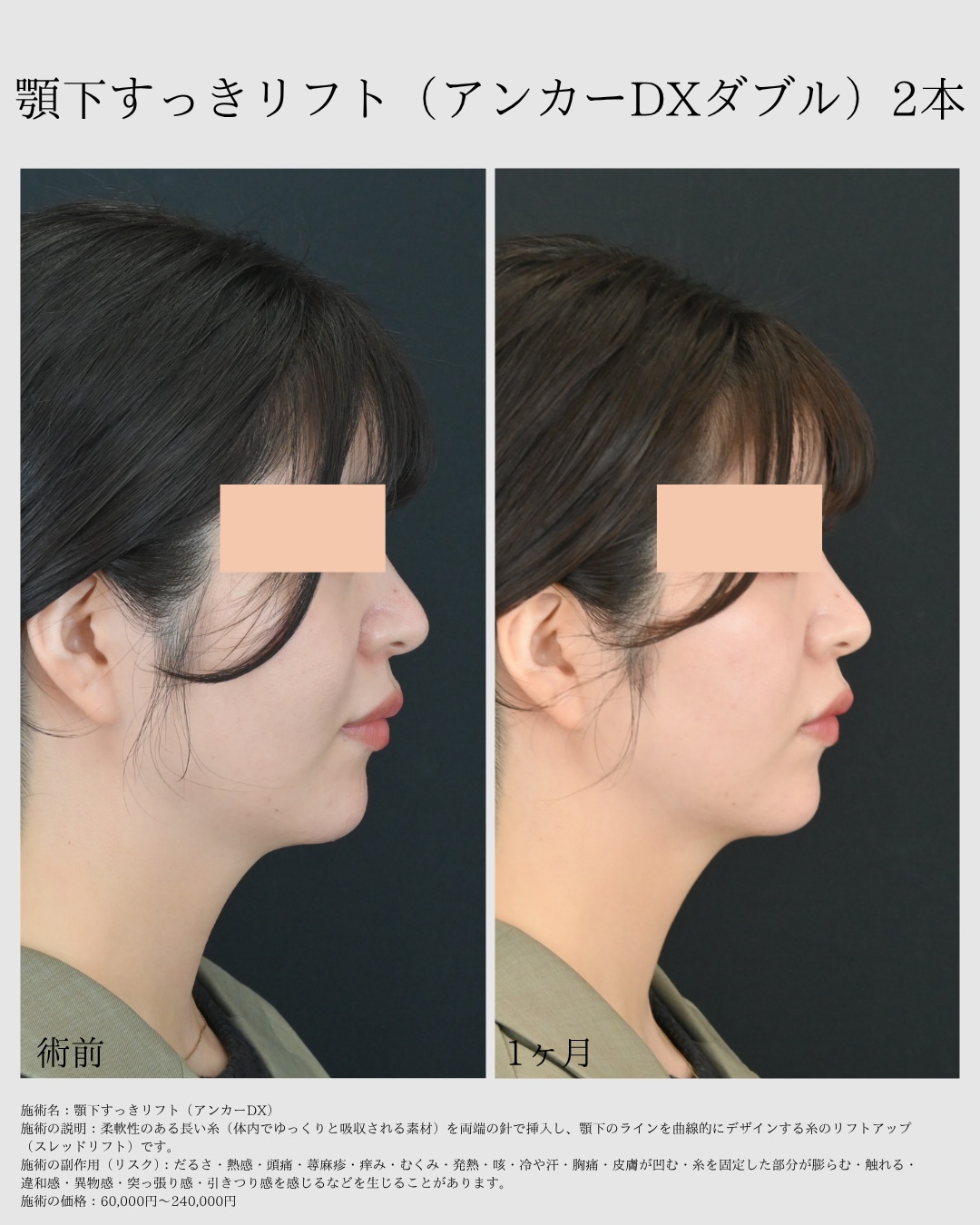 最新治療×症例数No.1ドクター