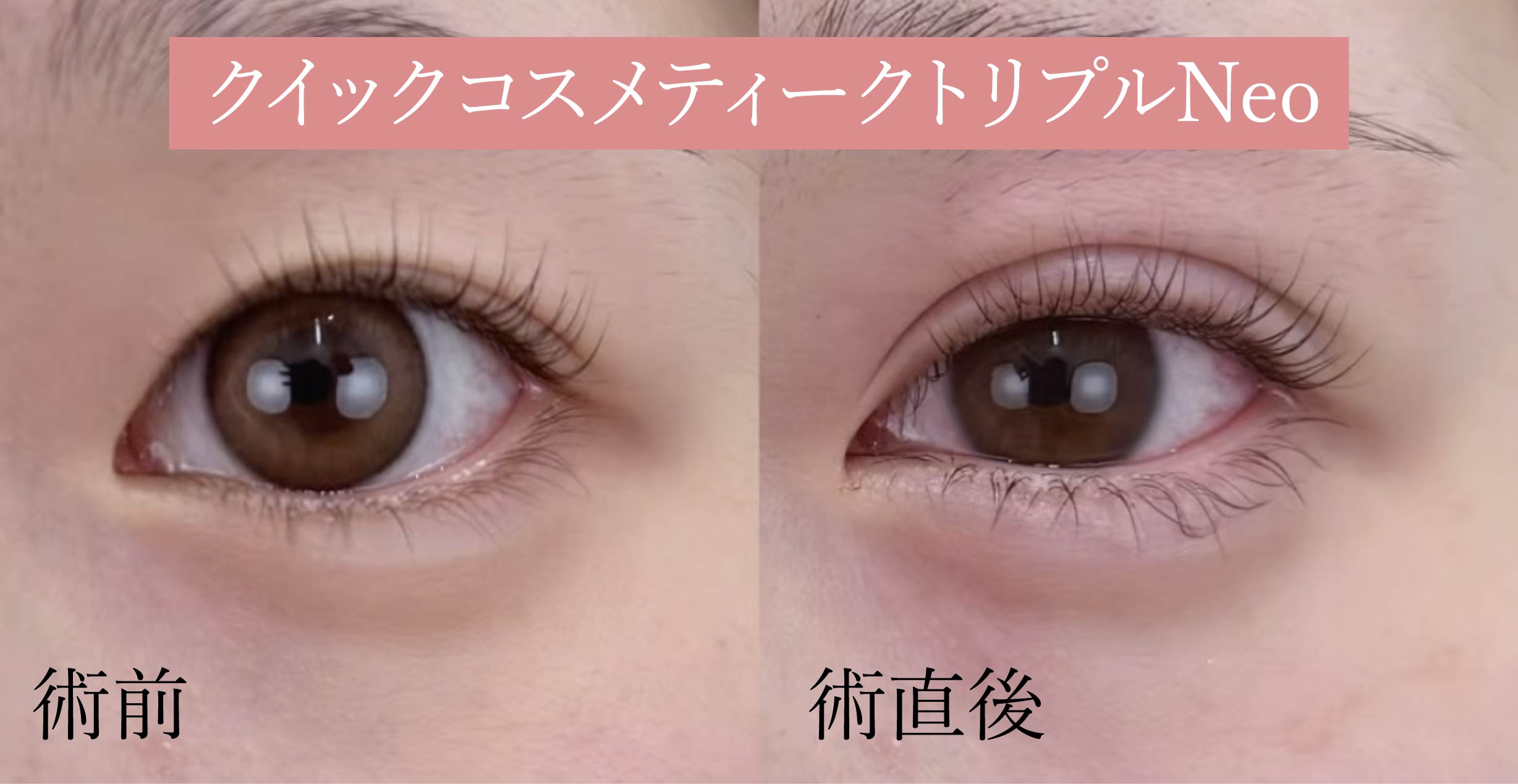 直後からきれい