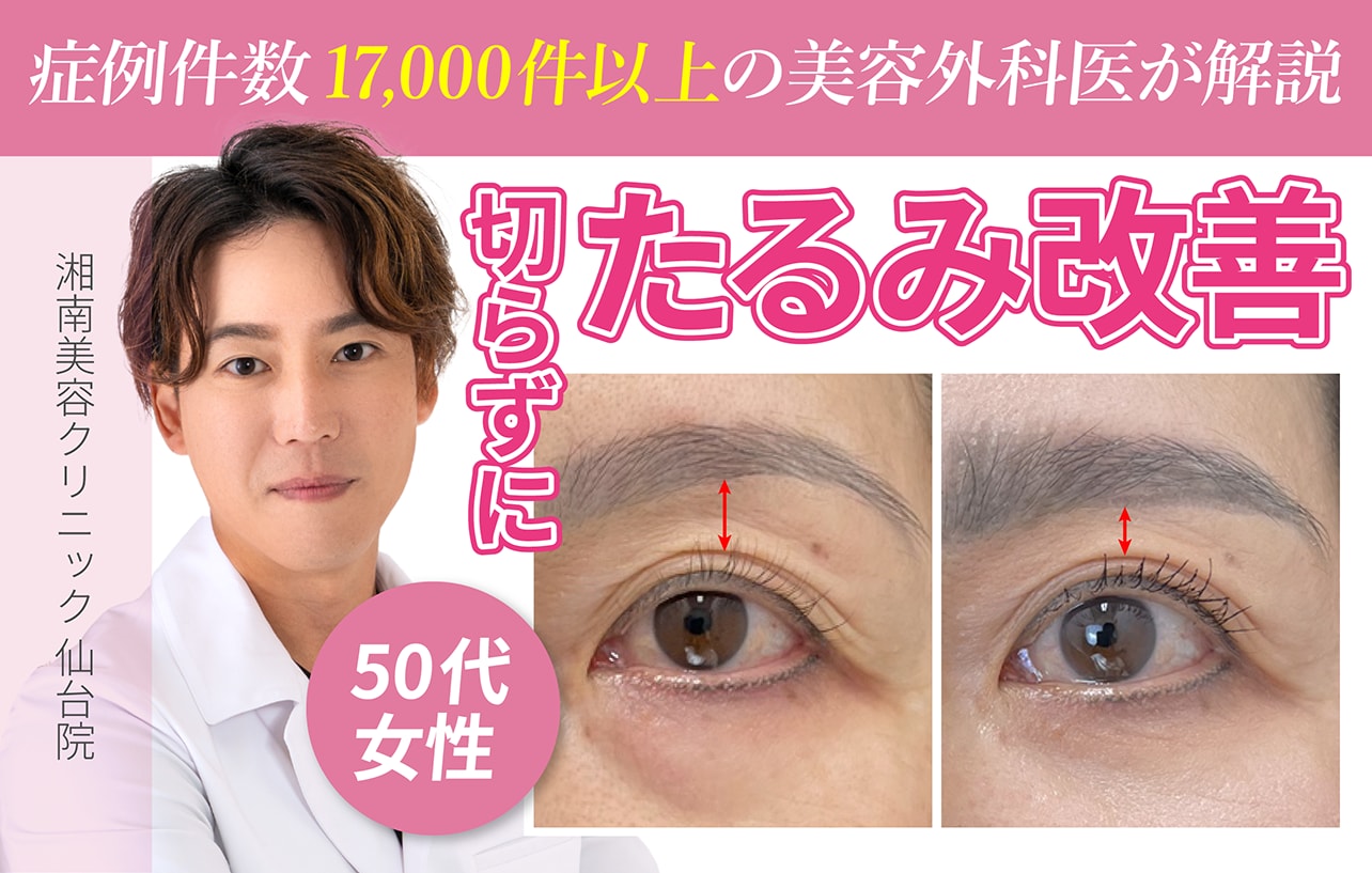 【40代からの二重整形】埋没法二重術で皮膚を切らずにまぶたのたるみを改善！ミドル世代の二重が人気な理由【仙台・東北】