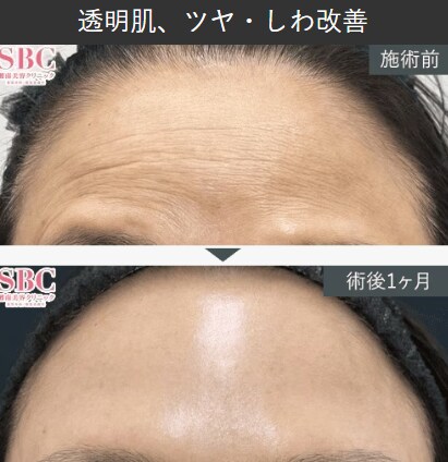 症例写真