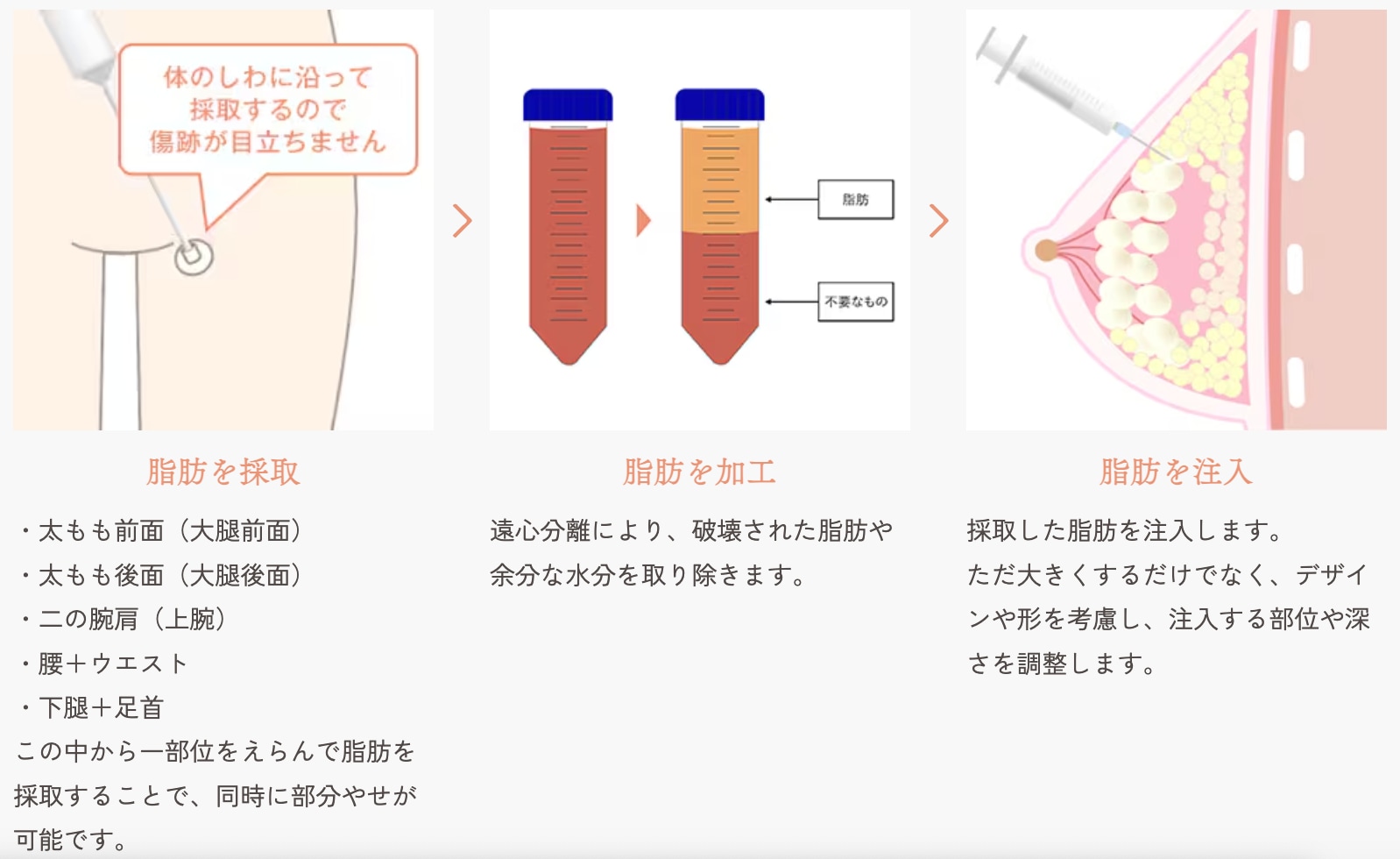どんな治療なの？