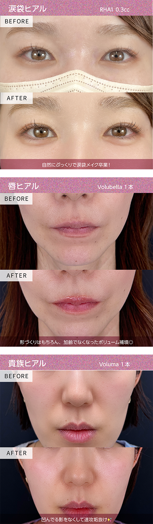 涙袋・唇・貴族