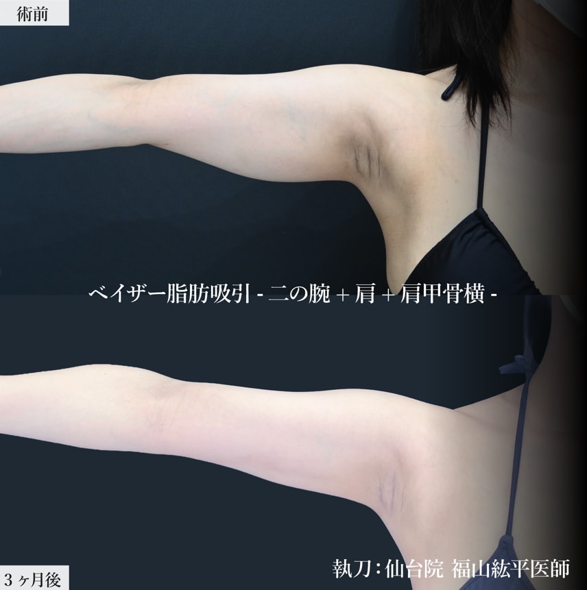 連休にしたい施術といえばこれ！