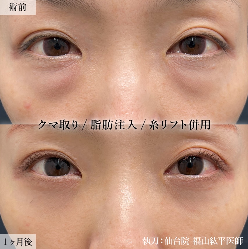 仙台院はクマ取りプレミアムドクター在籍！