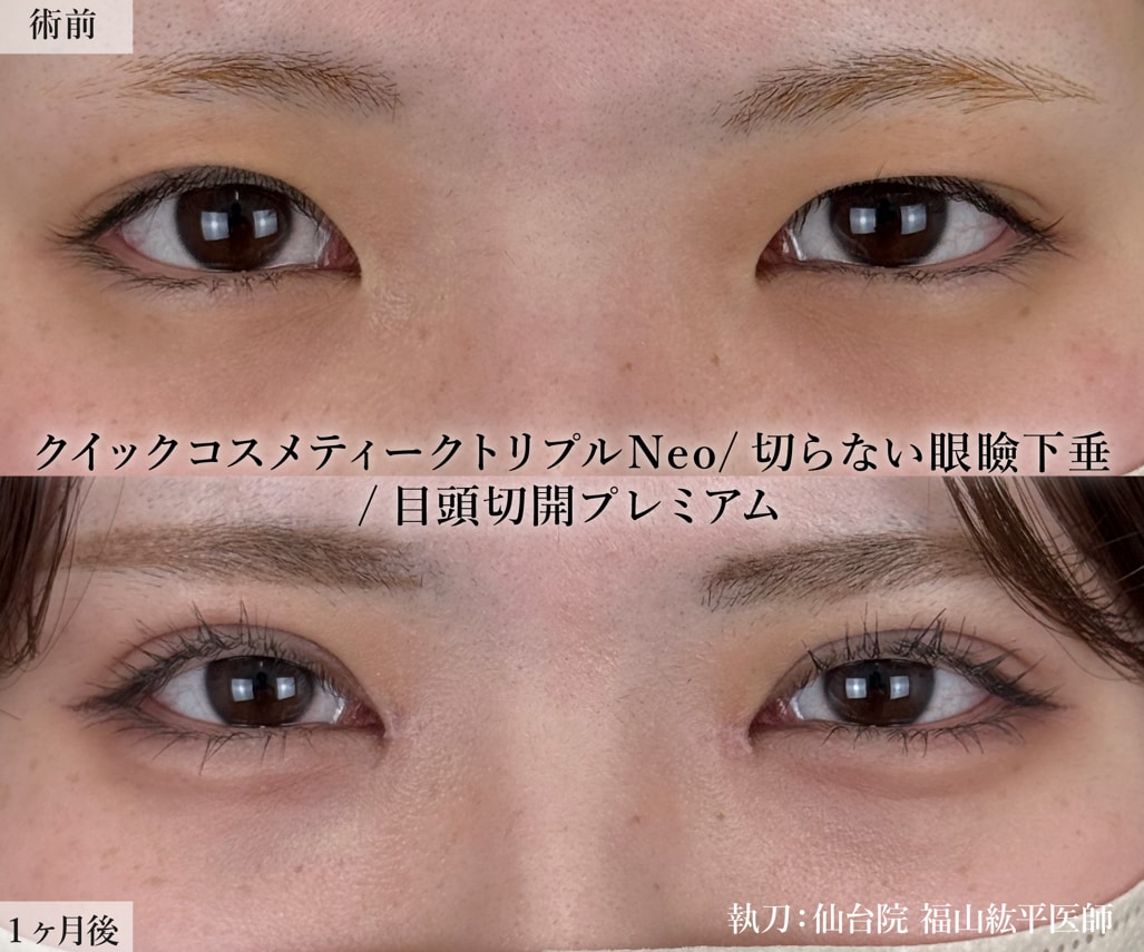 黄金比を導き出す、ミリ単位のこだわり