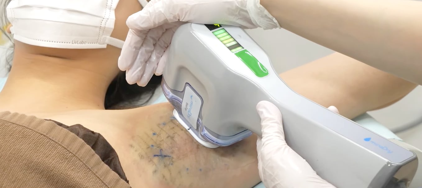 メスを使わない「切らない治療」の圧倒的メリット