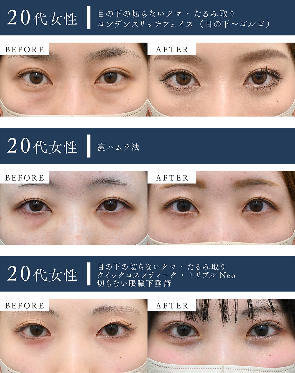 実は20代でもクマ取り適応の方、います！