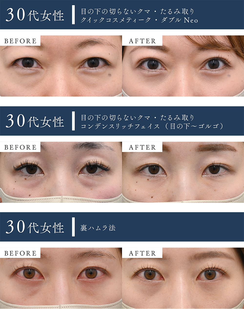やりすぎ感のない若返り✨