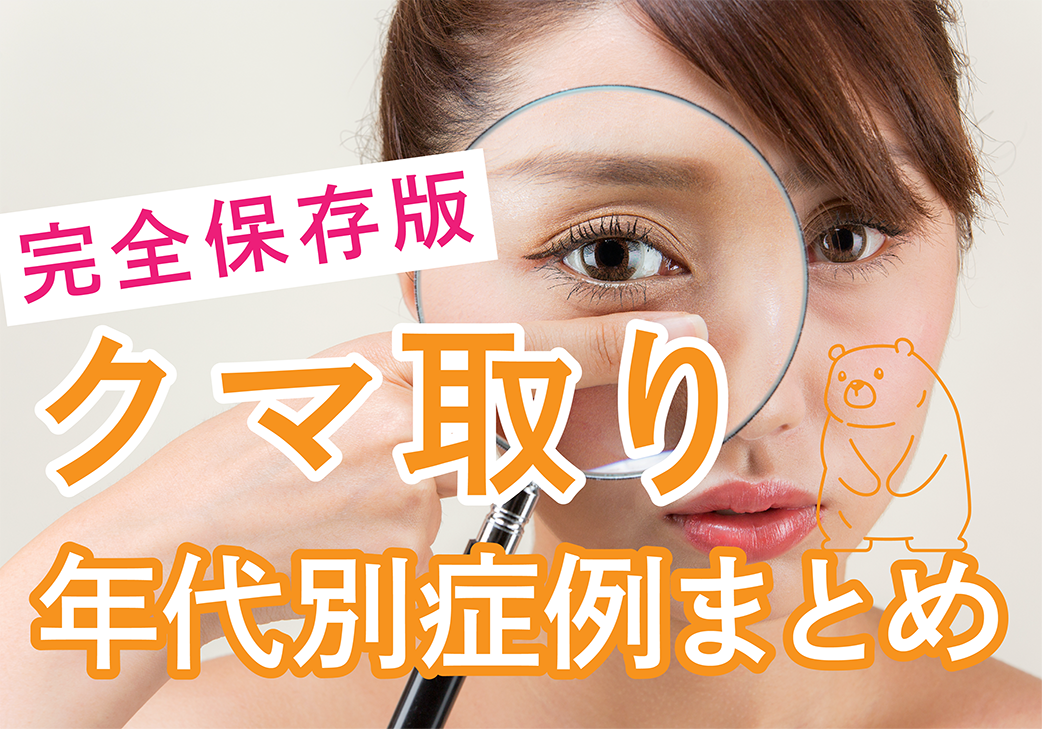 【必見👀】クマ取りで後悔しない‼️年代別症例写真まとめ🐻【湘南美容クリニック仙台院】