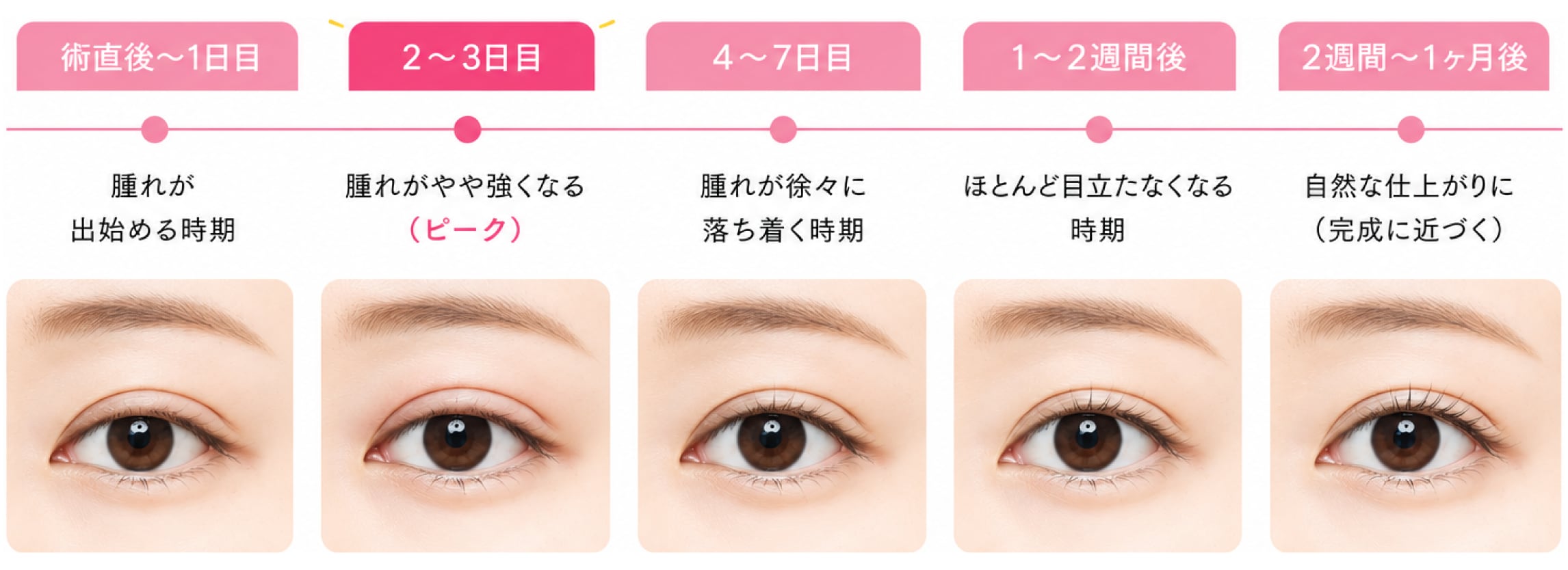 術後の腫れや内出血のピークと期間