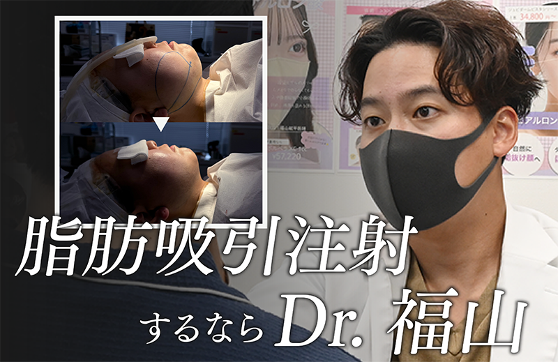 【仙台】短いダウンタイムでできる”脂肪吸引注射”【東北で脂肪吸引するなら湘南美容クリニック仙台院】