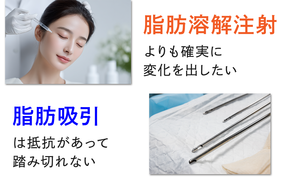 「脂肪溶解注射」と「脂肪吸引」の良いとこどり！
