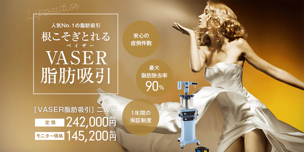ベイザー脂肪吸引