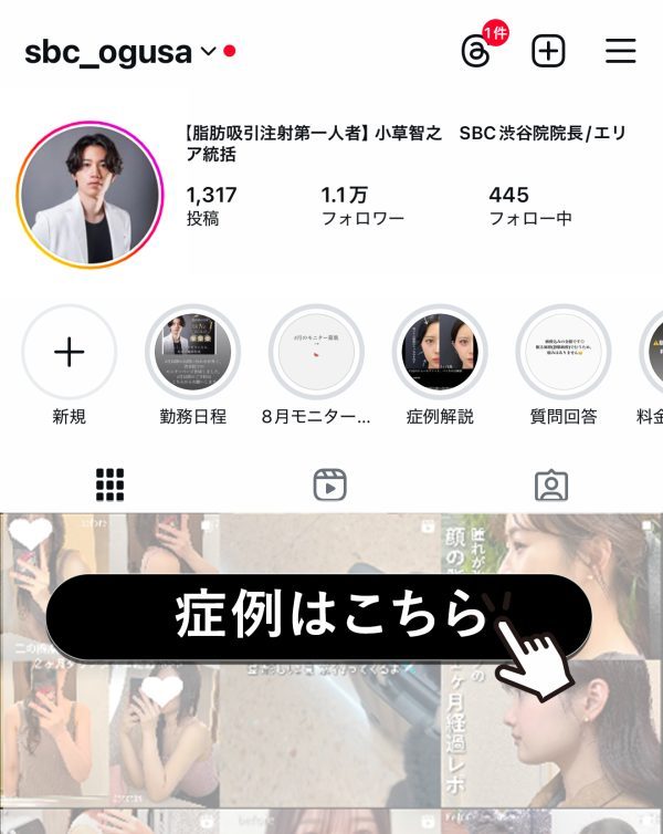 症例アカウントはこちら