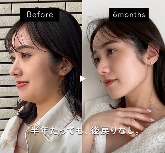 美しい仕上がりを実現するために