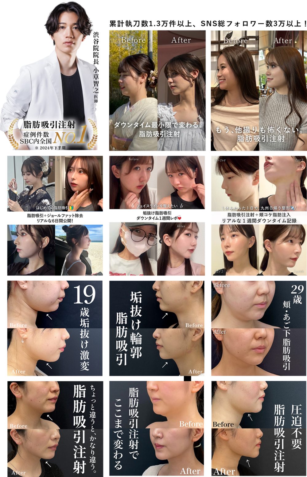 症例アカウントはこちら