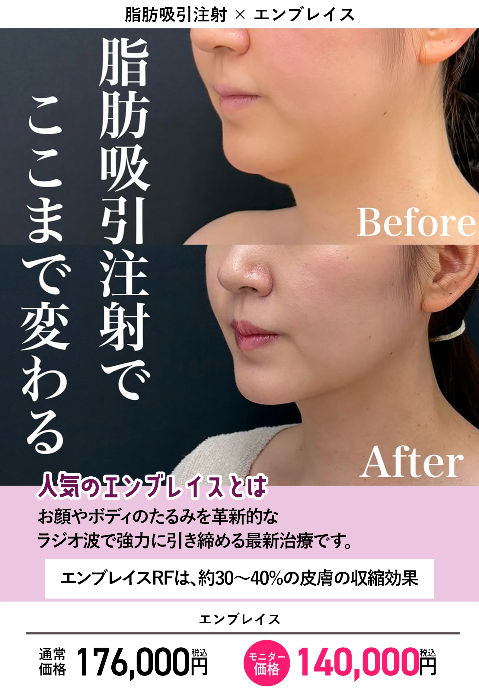 組み合わせ人気な理由