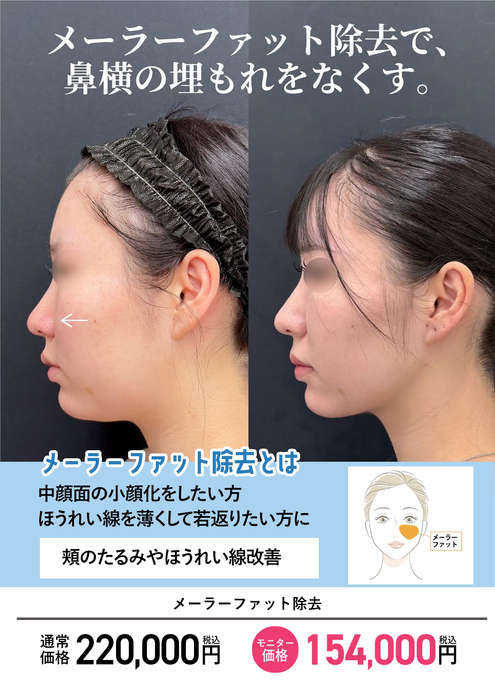 若々しくスッキリとした小顔に