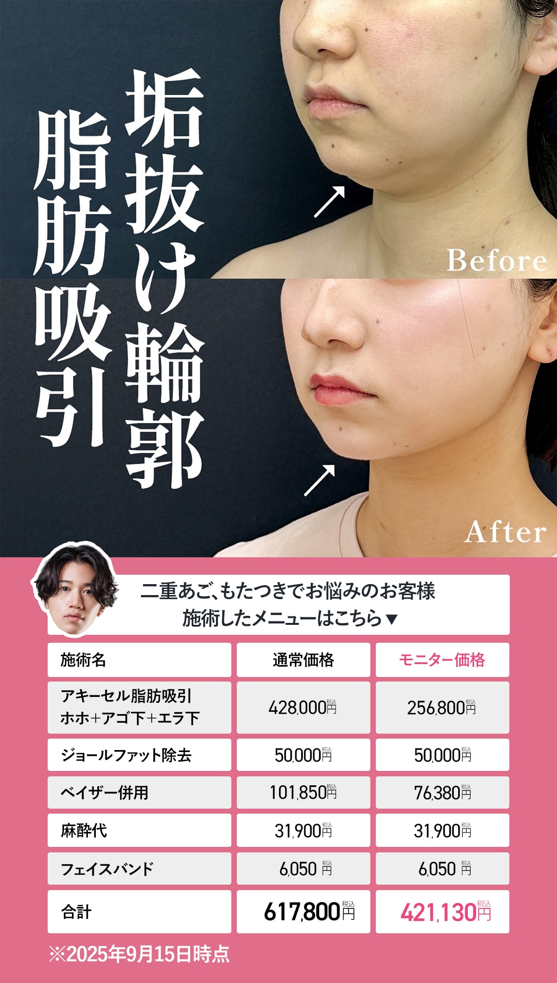 最小限の負担で最大の小顔効果