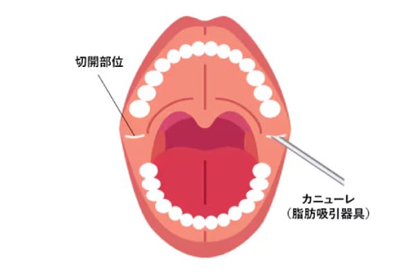 傷跡ほとんど目立たない!