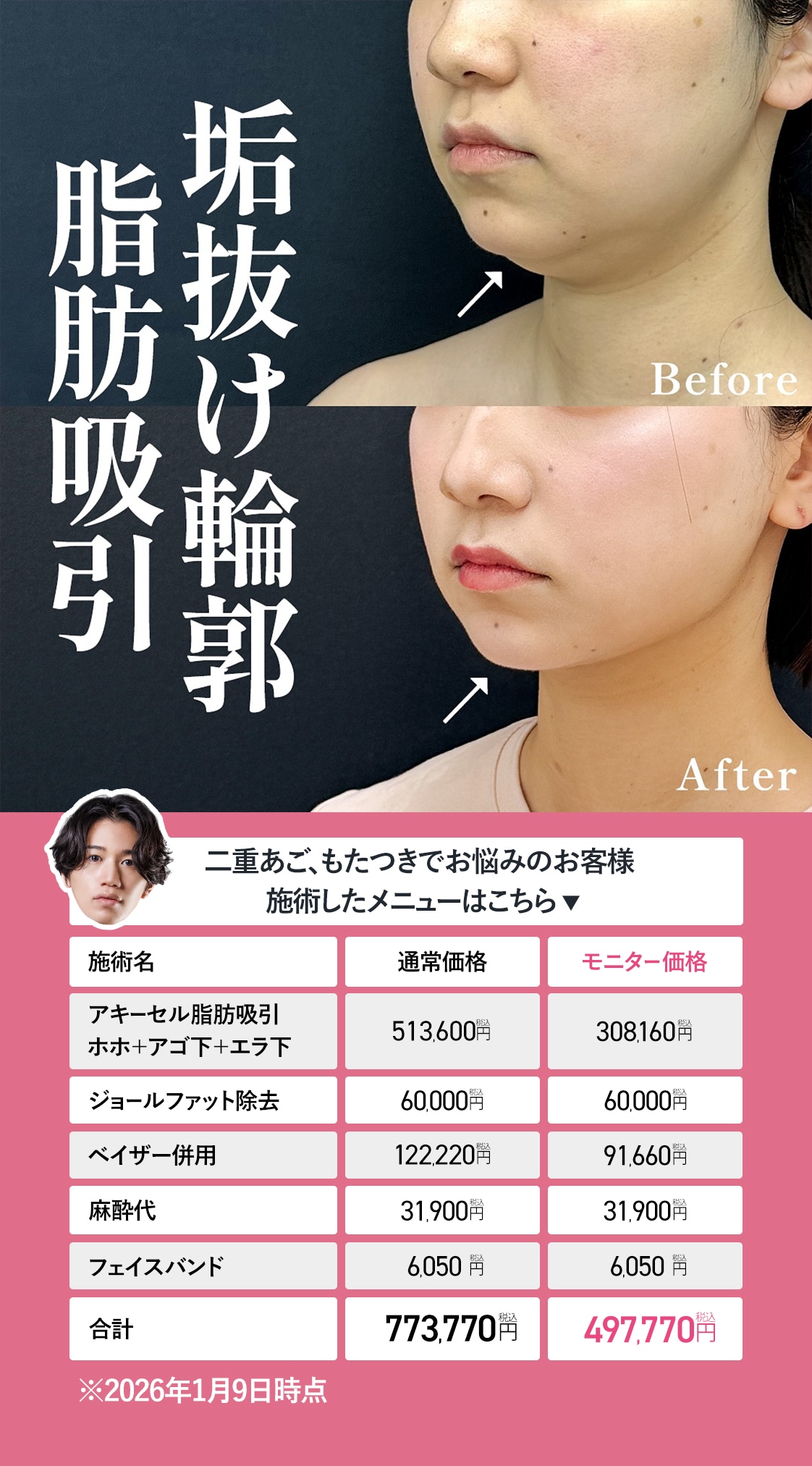 最小限の負担で最大の小顔効果