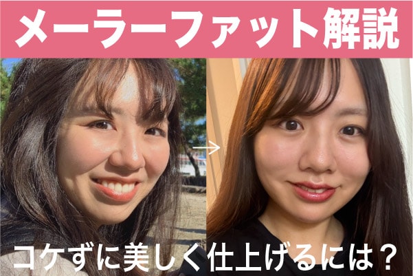 【中顔面短縮】メーラーファット除去でコケないための工夫