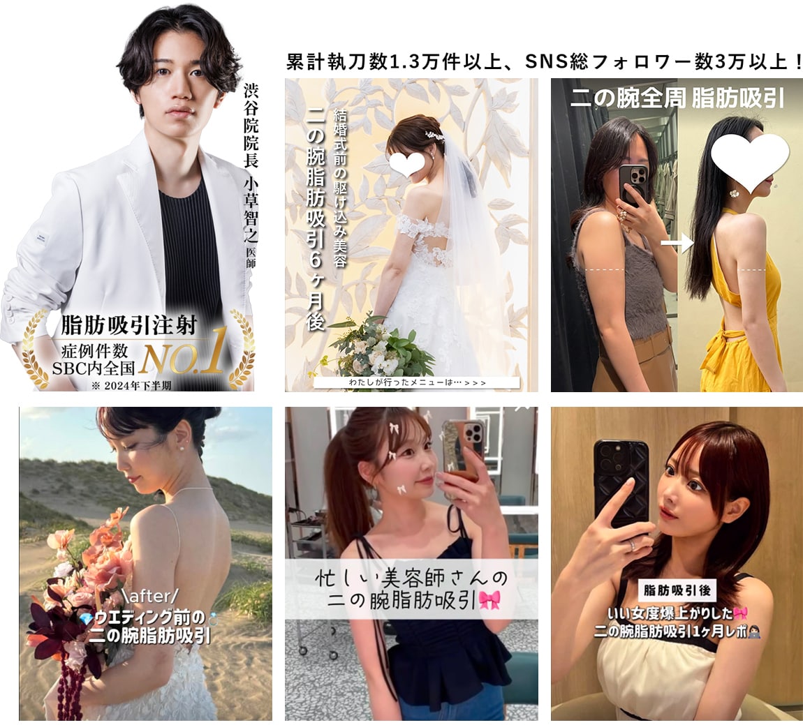 小草医師の写真、症例と総フォロワー1.3万人とかいてある