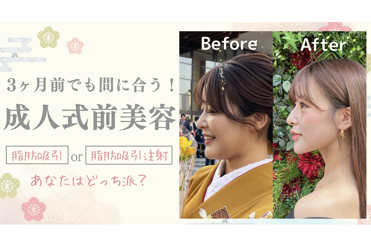 成人式前美容✨3ヶ月前でも間に合う脂肪吸引・脂肪吸引注射