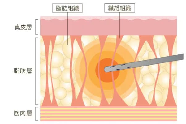 ダウンタイム短縮にも繋がる