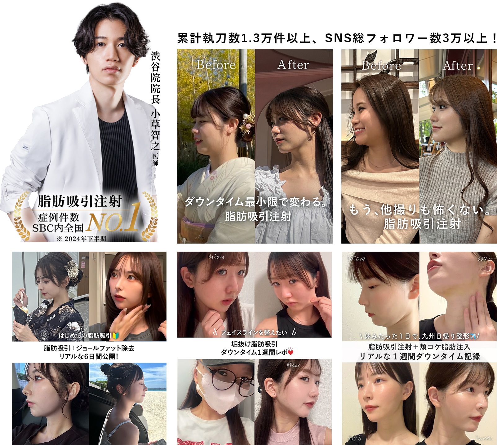 渋谷院院長 小草智之医師 症例実績No.1